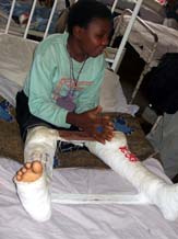 240108-2 No 12 Njinikom Hospital orthopedic